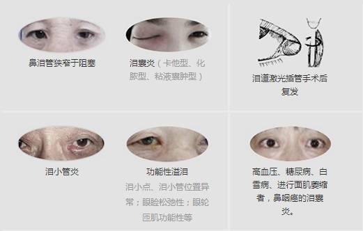 12月17日，普瑞淚道專家來(lái)疆親診，預(yù)約請(qǐng)速！