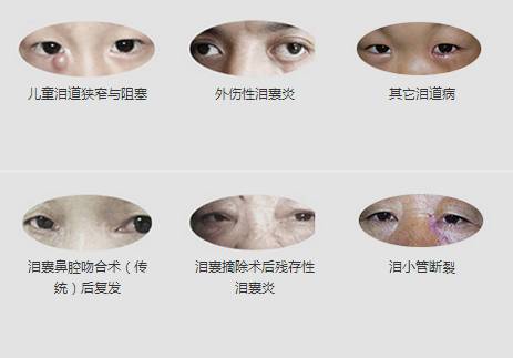 12月17日，普瑞淚道專家來(lái)疆親診，預(yù)約請(qǐng)速！